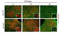 ستاد فرهنگسازی اقتصاد دانش بنیان The transcription factor NF-Y participates to stem cell fate decision and regeneration in adult skeletal muscle